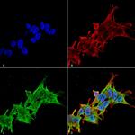 Leucine-Rich Repeat Kinase 2 (LRRK2) Antibody in Immunocytochemistry (ICC/IF)