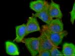 BCL2 Antibody in Immunocytochemistry (ICC/IF)