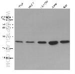 BCL2 Antibody in Western Blot (WB)