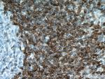 BCL2 Antibody in Immunohistochemistry (Paraffin) (IHC (P))