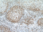 BCL2 Antibody in Immunohistochemistry (Paraffin) (IHC (P))