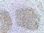 BCL2 Antibody in Immunohistochemistry (Paraffin) (IHC (P))