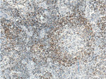 BCL2 Antibody in Immunohistochemistry (Paraffin) (IHC (P))