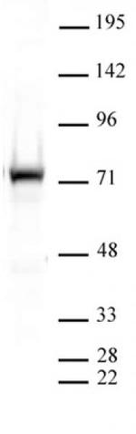 PRMT5 Antibody in Western Blot (WB)