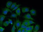 14-3-3 sigma Antibody in Immunocytochemistry (ICC/IF)