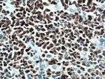 BCL6 Antibody in Immunohistochemistry (Paraffin) (IHC (P))