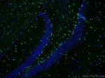 SOX2 Antibody in Immunohistochemistry (PFA fixed) (IHC (PFA))