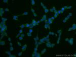 SOD1 Antibody in Immunocytochemistry (ICC/IF)