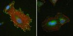 Vinculin Antibody in Immunocytochemistry (ICC/IF)