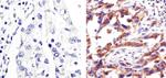 Caspase 3 Antibody in Immunohistochemistry (Paraffin) (IHC (P))