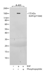 Phospho-EGFR (Tyr1068) Antibody in Western Blot (WB)