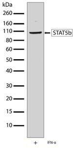 STAT5 beta Antibody in Western Blot (WB)