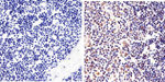 STAT6 Antibody in Immunohistochemistry (Paraffin) (IHC (P))