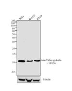 beta-2 Microglobulin Antibody in Western Blot (WB)