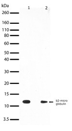 beta-2 Microglobulin Antibody in Western Blot (WB)