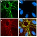 P-Selectin Antibody in Immunocytochemistry (ICC/IF)