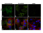 Glutaminase Antibody in Immunocytochemistry (ICC/IF)