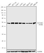 SUV39H1 Antibody in Western Blot (WB)