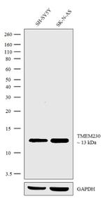 TMEM230 Antibody in Western Blot (WB)