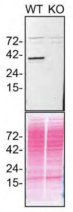 STING Antibody in Western Blot (WB)