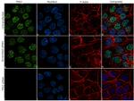 TP63 Antibody