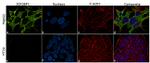 IGF2BP1 Antibody