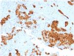 Calretinin/Calbindin 2 Antibody in Immunohistochemistry (Paraffin) (IHC (P))