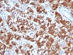 IL18R1 Antibody in Immunohistochemistry (Paraffin) (IHC (P))