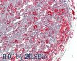 beta-tubulin Antibody in Immunohistochemistry (Paraffin) (IHC (P))