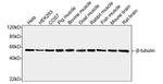 beta-tubulin Antibody in Western Blot (WB)