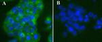 Mouse IgG (H+L) Cross-Adsorbed Secondary Antibody in Immunocytochemistry (ICC/IF)