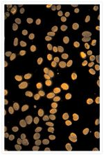 Mouse IgG (H+L) Cross-Adsorbed Secondary Antibody in Immunocytochemistry (ICC/IF)