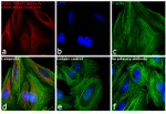 Rabbit IgG (H+L) Cross-Adsorbed Secondary Antibody in Immunocytochemistry (ICC/IF)