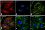 Rabbit IgG (H+L) Cross-Adsorbed Secondary Antibody in Immunocytochemistry (ICC/IF)