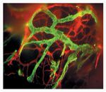 Mouse IgG (H+L) Highly Cross-Adsorbed Secondary Antibody in Immunocytochemistry (ICC/IF)