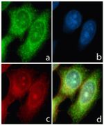 Rabbit IgG (H+L) Highly Cross-Adsorbed Secondary Antibody in Immunocytochemistry (ICC/IF)