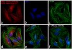 Rabbit IgG (H+L) Highly Cross-Adsorbed Secondary Antibody in Immunocytochemistry (ICC/IF)