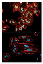 Golgin-97 Antibody in Immunocytochemistry (ICC/IF)