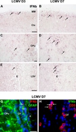 GFAP Antibody in Immunohistochemistry (IHC)