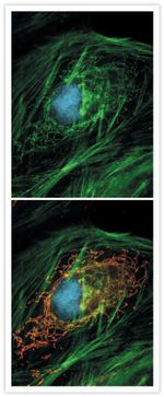 Mouse IgG (H+L) Cross-Adsorbed Secondary Antibody in Immunocytochemistry (ICC/IF)