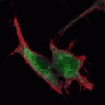 Mouse IgG (H+L) Highly Cross-Adsorbed Secondary Antibody in Immunocytochemistry (ICC/IF)