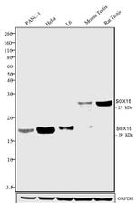 Rabbit IgG (Heavy chain) Secondary Antibody in Western Blot (WB)