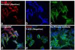 Mouse IgG (H+L) Highly Cross-Adsorbed Secondary Antibody in Immunocytochemistry (ICC/IF)