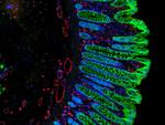 Mouse IgG (H+L) Cross-Adsorbed Secondary Antibody in Immunohistochemistry (Paraffin) (IHC (P))