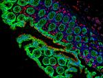 Mouse IgG (H+L) Cross-Adsorbed Secondary Antibody in Immunohistochemistry (Paraffin) (IHC (P))