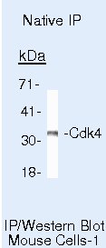 CDK4 Antibody in Immunoprecipitation (IP)