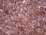 APOE Antibody in Immunohistochemistry (Paraffin) (IHC (P))