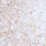 ATP5A1 Antibody in Immunohistochemistry (IHC)