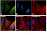 Mouse IgG (H+L) Cross-Adsorbed Secondary Antibody in Immunocytochemistry (ICC/IF)