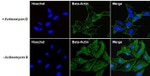 beta Actin Antibody